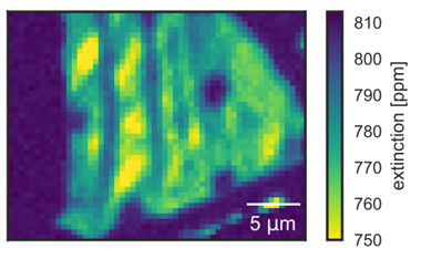 Ultra-sensitive absorption microscope